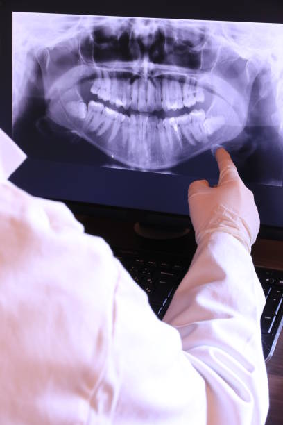 Best Emergency Denture Repair in Wollochet, WA